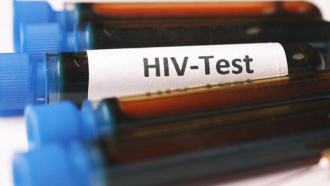 斐济HIV感染激增 政府宣布全国紧急状态